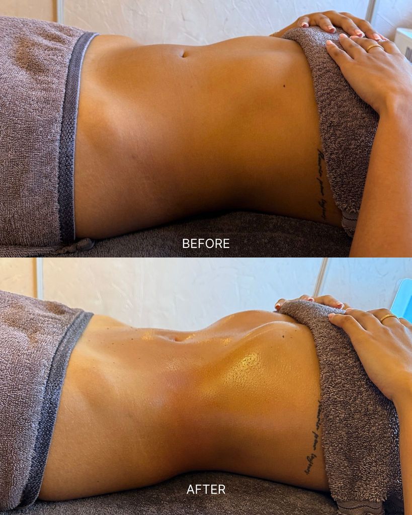 A client's results at Dimple Amani