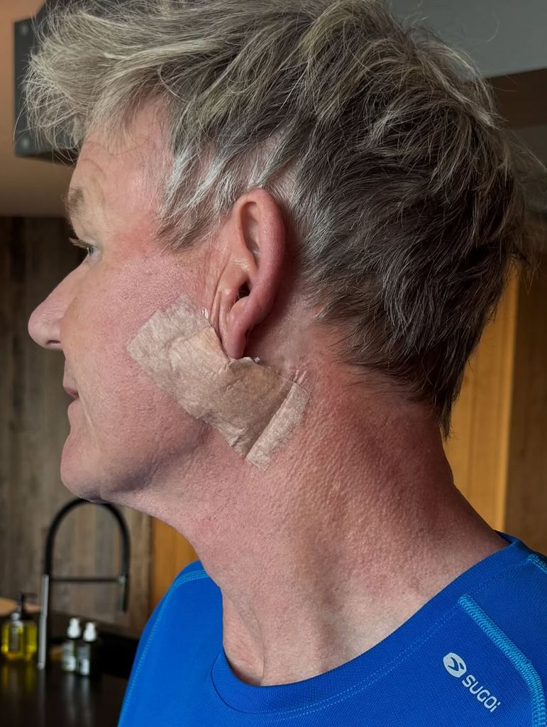 Grateful' Gordon Ramsay, 58, inundated with support following skin cancer scare | HELLO!