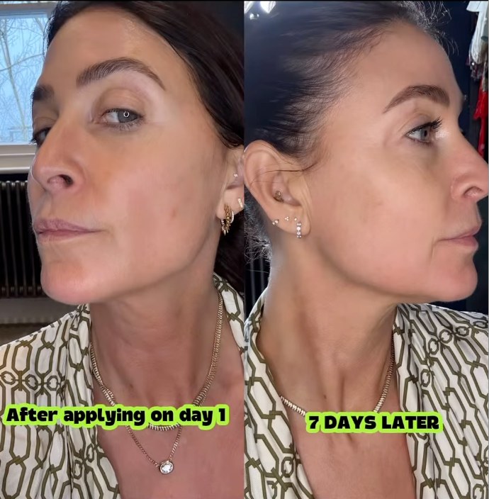 Lisa Snowdon's before and after pictures after using the Boost Lab Firming Neck Serum