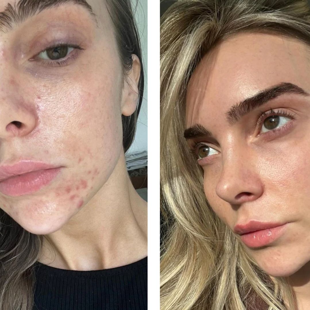 The £39.99 'Miracle Skin' treatment shoppers describe as 'unreal' and 'unbelievable' 