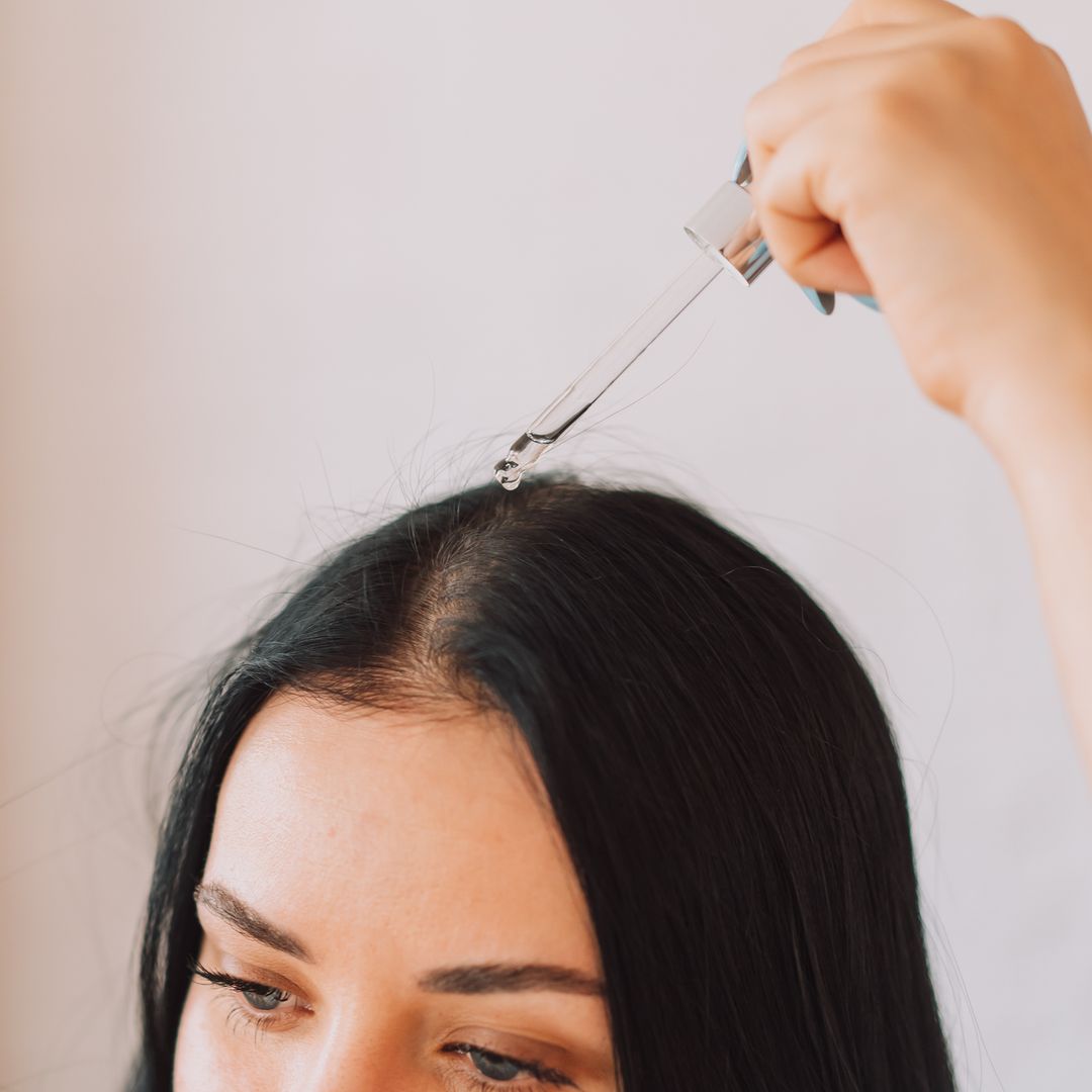 I've tried everything for my scalp psoriasis – here's what finally helped